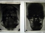 Рентгеновские снимки головы Гитлера выставлены на eBay